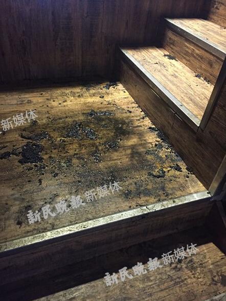 SNH48成員唐安琪遇意外嚴重燒傷 SNH48成員唐安琪遇意外嚴重燒傷