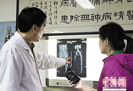 河北自鋸腿農(nóng)民已確定治療初步方案