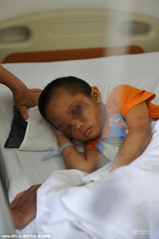 圖為全身傷痕累累的小進(jìn)。