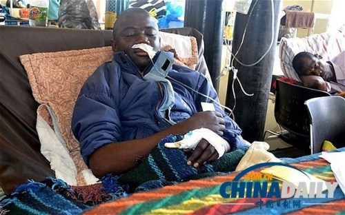 雖然已經(jīng)在醫(yī)院接受了近一個月的恢復治療，卡托卡的身體仍然非常虛弱。