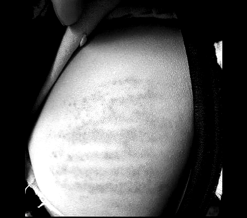 沒(méi)帶作業(yè)本 信陽(yáng)潢川4歲娃兒遭老師輪番鞭打 沒(méi)帶作業(yè)本 信陽(yáng)潢川4歲娃兒遭老師輪番鞭打