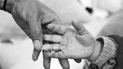 手足口病進入高發(fā)季 河南省幼兒園開始每日晨檢 手足口病進入高發(fā)季 河南省幼兒園開始每日晨檢