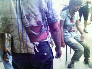 廈門(mén)公交起火爆炸已造成48人死亡 約30人受傷 廈門(mén)公交起火爆炸已造成48人死亡 約30人受傷