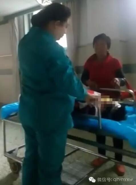 涵涵爸爸告訴《每日新聞》記者：“沒想到是熱水，大人也沒看，一時疏忽，掉進去了。抱出來的時候這個皮已經(jīng)掉了。”