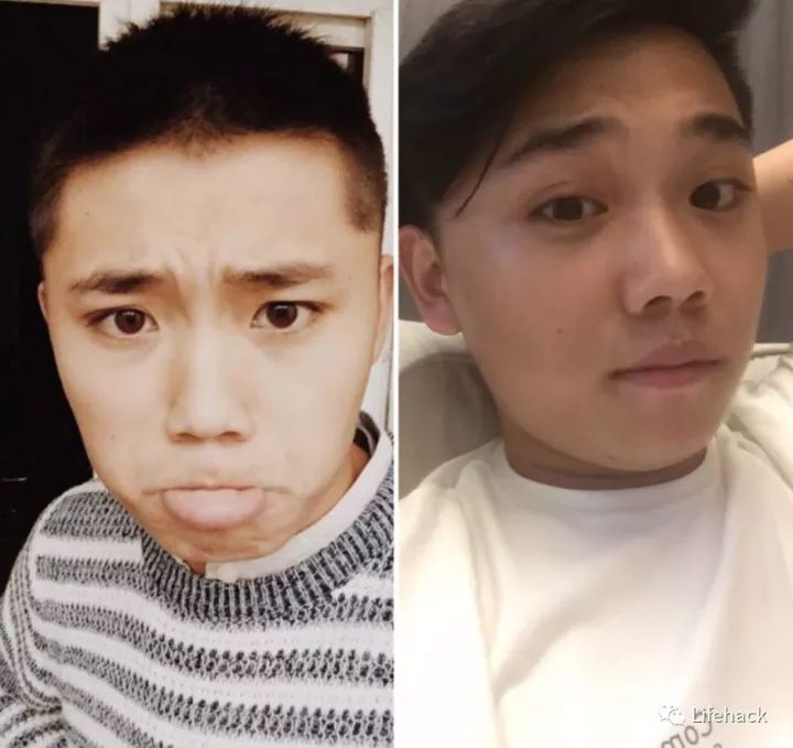 長胖20斤，臉型怎么變？這些例子看完扎心了！