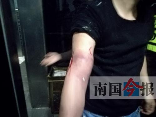 覃先生手臂被卡的部位受傷流血，所幸傷勢(shì)無大礙。 通訊員 王建民 攝