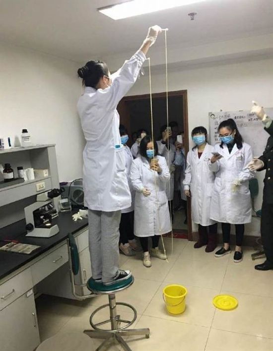 愛吃生肉惹的禍！男子體內(nèi)取出5米長寄生蟲(圖)