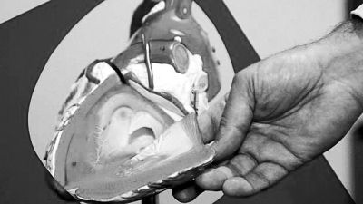 威廉斯領(lǐng)導(dǎo)的研究團隊已經(jīng)利用人體脂肪干細胞，成功3D打印出心臟血管和心臟瓣膜，待一顆心臟的所有部件打