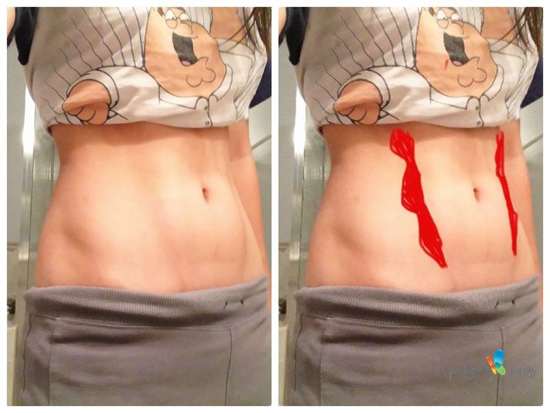 蔡依林 你的馬甲線(xiàn)“脫妝”了！