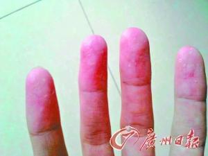 近百學(xué)生沒疊好被子遭體罰 校長:沒懲罰不叫教育