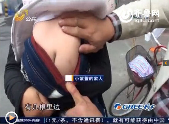 女?huà)塍w內(nèi)現(xiàn)16根鋼針無(wú)法取出 父母懷疑被下黑手 女?huà)塍w內(nèi)現(xiàn)16根鋼針無(wú)法取出 父母懷疑被下黑手