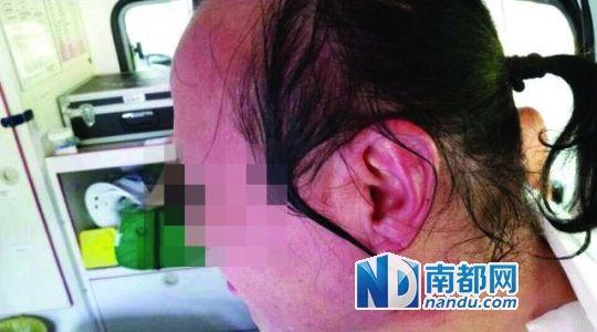 涉事教師遭熱水潑臉后的照片。