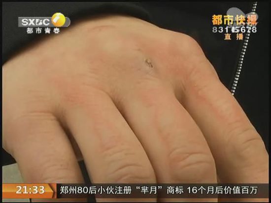 說到這足療拔罐，估計大伙都不陌生，但是想起4號晚上的拔罐的經(jīng)歷，呂先生現(xiàn)在想起來，還心有余悸。