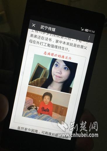 25歲少女患怪病“逆生長” 半年矮了13厘米(圖) 25歲少女患怪病“逆生長” 半年矮了13厘米(圖)