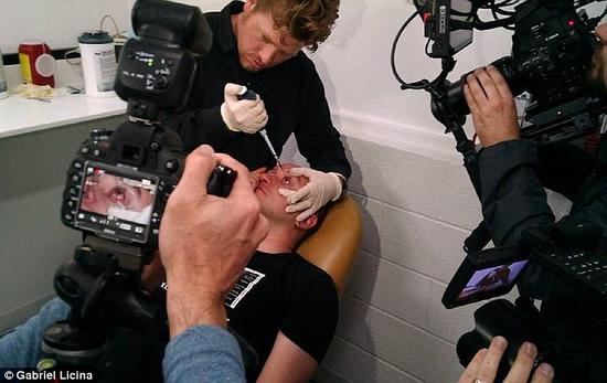 該實(shí)驗(yàn)是由加州一支名為“生物駭客”的實(shí)驗(yàn)團(tuán)隊(duì)開展的。他們使用了一種名為二氫卟吩e6（Ce6）的物質(zhì)的溶液。Ce6常見于深海魚體內(nèi)，有光敏特性，通常用于癌癥治療研究中。研究團(tuán)隊(duì)將Ce6與胰島素和鹽水混合起來，得到一種溶液，可以在低光照條件下提高人類的視力。